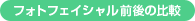 �t�H�g�t�F�C�V�����O��̔�r